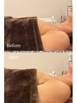 プリマベラ 大阪梅田(primabella)/バストの丸み