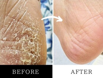 キムズライフ フットケア(Kim’slife)