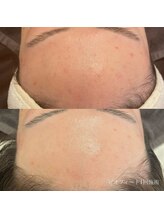 エクラ(eclat)/クリスティーナ