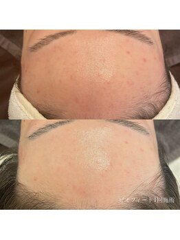 エクラ(eclat)/クリスティーナ