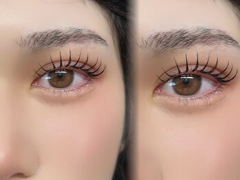 ポース(phoOs)/アンドヘルシー80本