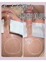 ヒーリングリゾート ナゴミ(Nagomi)/クリスタルフォト