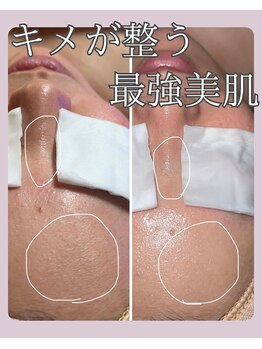 ヒーリングリゾート ナゴミ(Nagomi)/クリスタルフォト