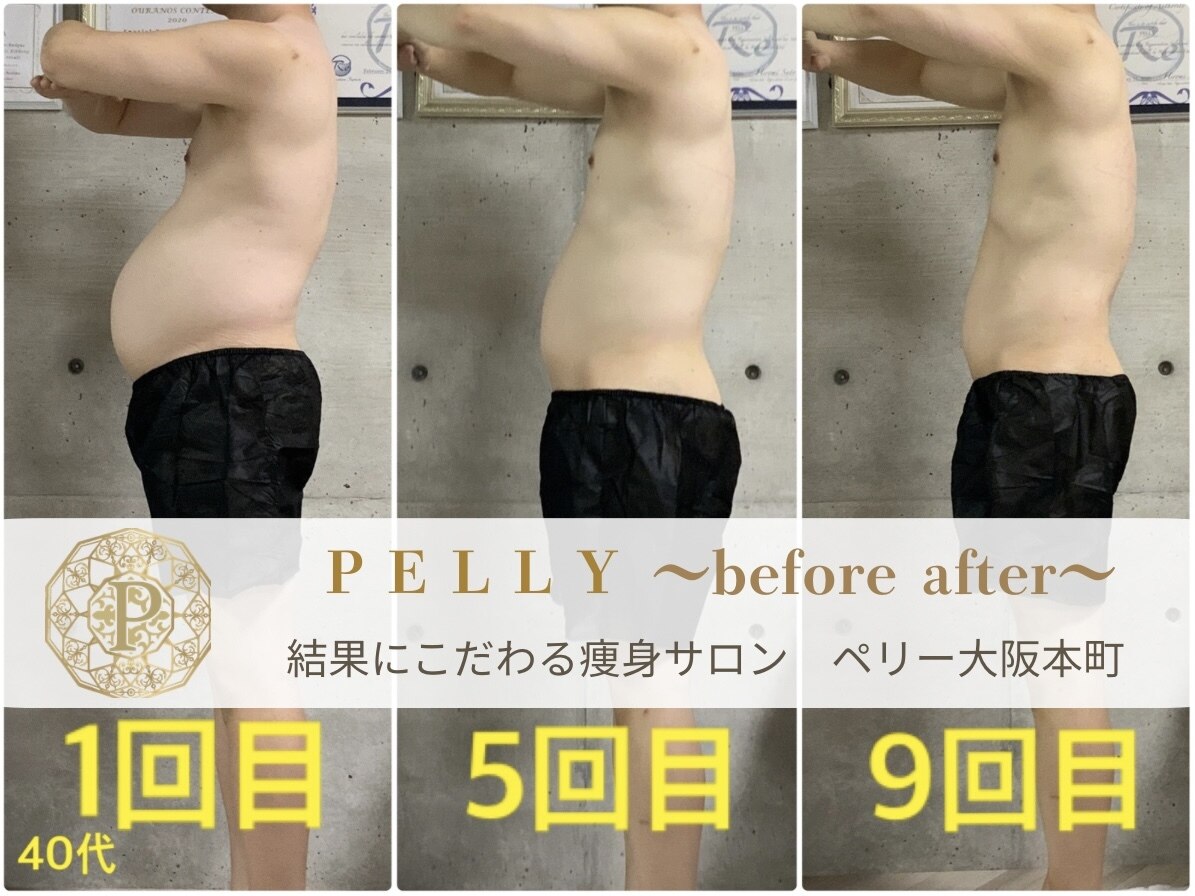 PRセル 吸引.痩身(大中小ヘッド付、送料込) ペリー(PELLY)｜ホットペッパービューティー