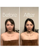 グレースフィオーレ 町田店(gracefiore)/ビフォーアフター/施術1回の効果