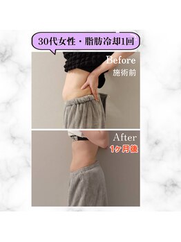 グランディールアン(GRANDIR UN)/さらに変化