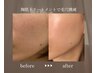 【ツルっと憧れの毛穴レス肌へ】陶肌トリートメント 60分 通常￥16,500