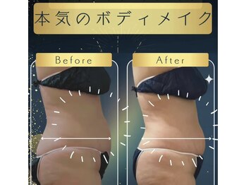 ラフィール/圧倒的beer After :1回