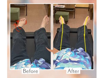 くすの木 治療院/カラダの歪みと足