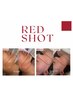 【韓国最新美容】REDSHOT脂肪分解×リフトアップフェイシャル