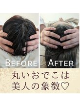 スウ(suu.)/Before-After【30代】1回