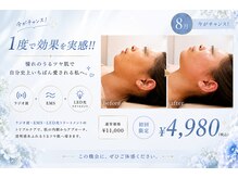レディアンス