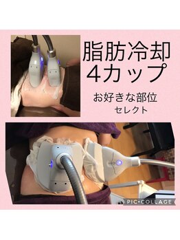 サロン ド ルルアス(Salon de LuLuas)/脂肪冷却