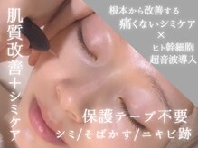 シミにピンポイントでアプローチ★同時に肌質改善も叶う