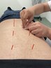 【不眠などでお悩みの方に！】鍼灸施術で睡眠の質を向上！￥5450→1920