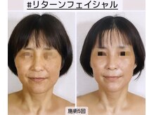 真美(Sinbi)/リターンフェイシャル