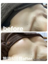 ギンザアール(GINZA R.)/バストアップに♪