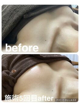 ギンザアール(GINZA R.)/バストアップに♪