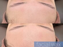 レーヴ(REVE)/フェイシャルワックス（おでこ）