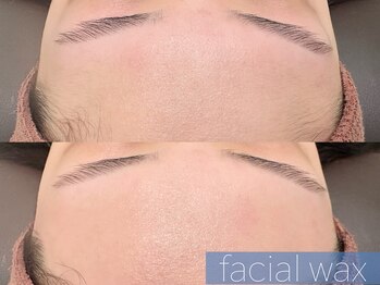 レーヴ(REVE)/フェイシャルワックス（おでこ）