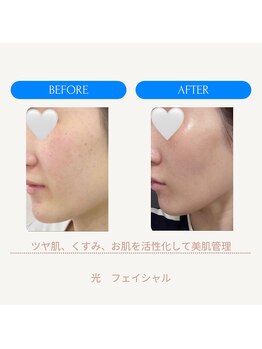 ムーンライズ(moonrise)/