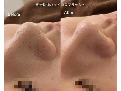 リアン(Lien)の写真