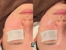 グレイスリリー 久屋 栄(grace lily)/