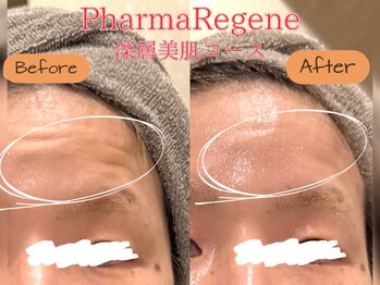 レイネ(REINE)/ファーマリジェネ生コラーゲン