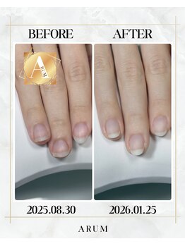 Luxury escape 自爪育成