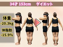 ほんじょう整骨院 美容整体/北九州/八幡西区/ダイエット