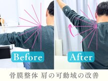 整体ヒラメント 藤沢院(Hilament)/ビフォーアフター：肩の可動域