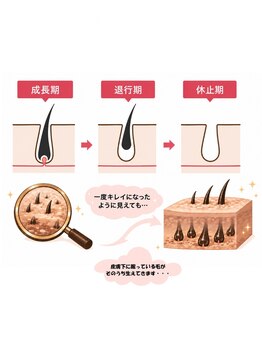 ジョエルワックス 沖縄那覇店(JOELLE WAX)/毛の生え変わりに合わせた脱毛を