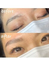 アンベリール(embellir)/ハリウッドブロウリフト(HBL)