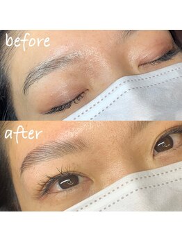 アンベリール(embellir)/ハリウッドブロウリフト(HBL)