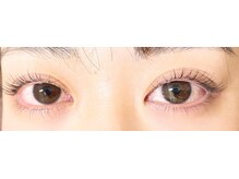 チャオ(Ciao)/上下ラッシュリフト