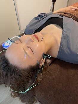 ハリファ鍼灸院 横浜関内院(HariFa鍼灸院)/美容鍼