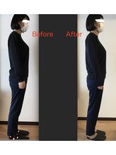 ボディラボカワサキ(Body Labo Kawasaki)/ビフォアフター　約3ヶ月後