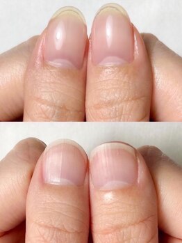 爪の悩みを解消できる（ケア含む）