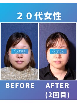 ぐっすりん/複数回継続のお客様の変化(10)