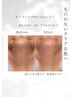 【肌管理】ごっそり毛穴洗浄＆WOTTヘッド（血流UP・むくみ・リフトUP）￥9800