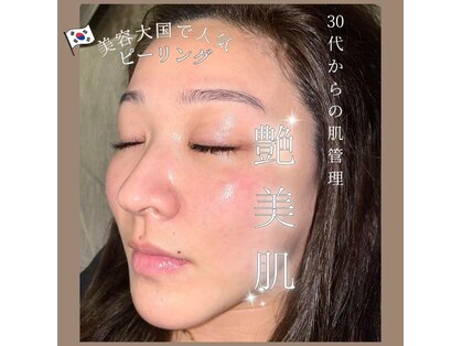 リノ(Lino)の写真
