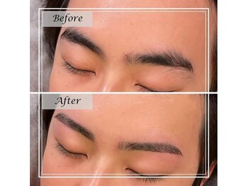 ロミオ(Romeo)/before/after