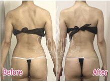 グラウディア 恵比寿/痩身/筋膜リリース/インディバ超