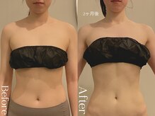 ユーフォリア グロウ(euphoria glow)/｛　ラフォス痩身90分 8回　 ｝