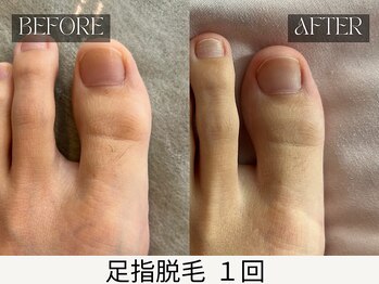 スキンジム(SKIN GYM)/“デキる男”は細部まで清潔に