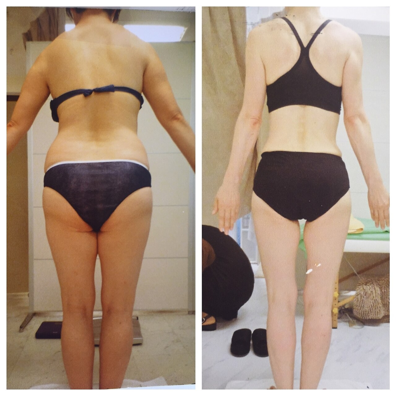 フォト｜痩身デトックスサロン ベルチェ 市川本八幡店｜ホットペッパー