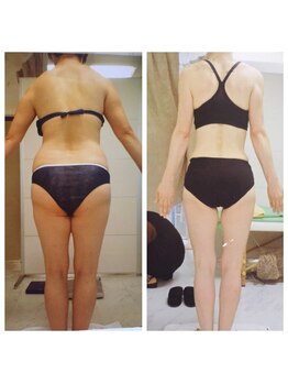 痩身デトックスサロン ベルチェ 市川本八幡店/◆リバウンドまでを考えて◆