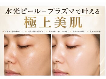 美的アヴェニール(美的.Avenir)の写真/《人気ＮO.1》【極上美肌】毛穴.くすみ.角質除去.ツヤ.透明感.ワントーンアップ◎  ノーファンデ肌へ☆