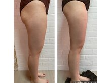 サロン ド ルルアス(Salon de LuLuas)/クワトロ下半身コース