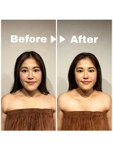 グレースフィオーレ 町田店(gracefiore)/ビフォーアフター/施術1回の効果